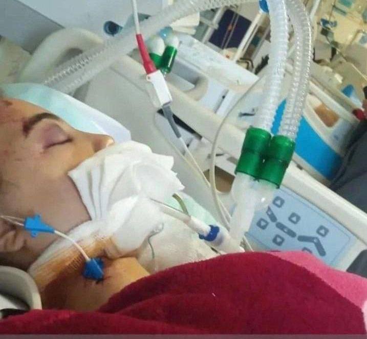 جزئیات تازه از حادثه برای دختر دانشآموز دهگلانی | هستی حسین پناهی» در بیمارستان کوثر سنندج بستری است