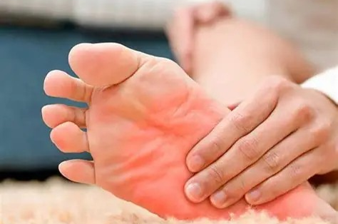 داغی و سوزش کف پا را جدی بگیرید