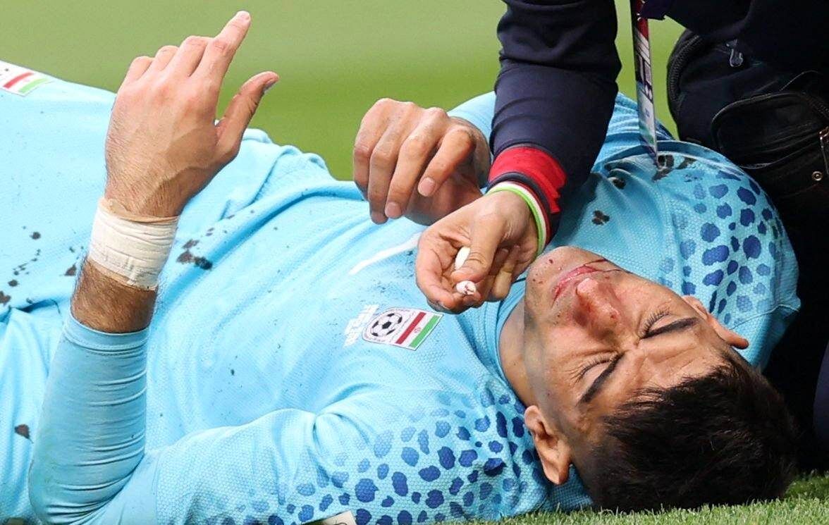 خبر بد وزیر ورزش درباره وضعیت «علیرضا بیراوند»