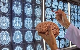 جراحی مغز و اعصاب؛ لیست بهترین متخصصان جراحی مغز و اعصاب

